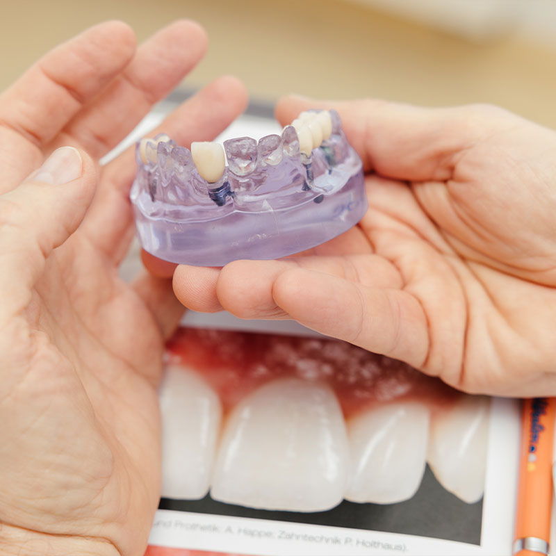 Kieferchirurgie Bremen