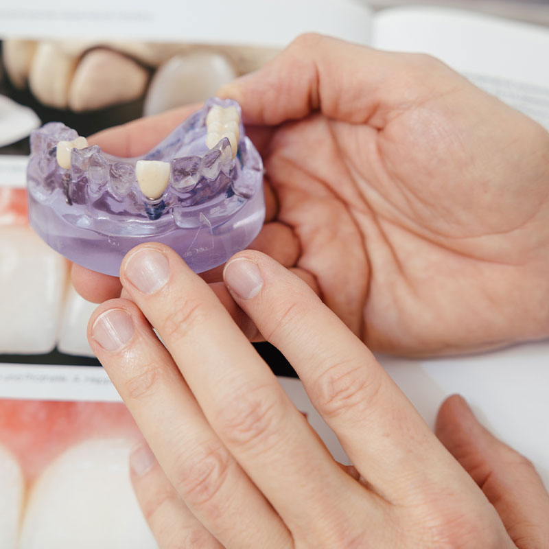 Zahnimplantologie Bremen Rosenberger